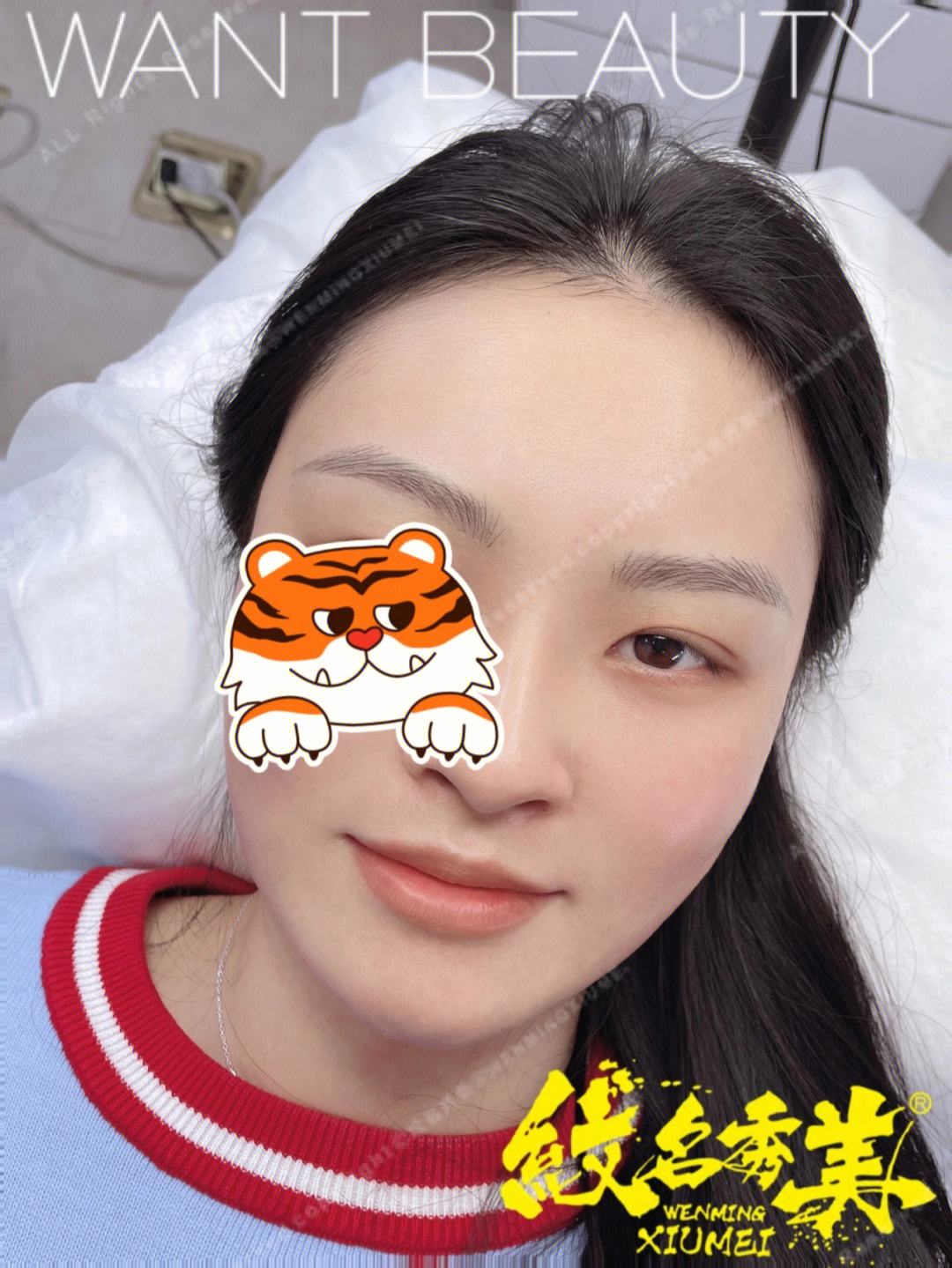 纹眉结痂快好不好 纹眉结痂快好不好怎么看