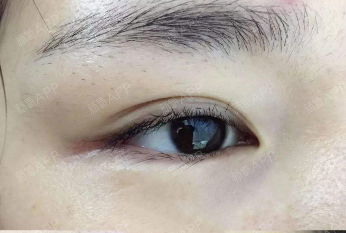 美容之后纹眉好不好呢 美容之后纹眉好不好呢图片